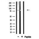 Western blot analysis of extracts from 293, using ADD3 Antibody.