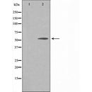 DF3515 at 1/100 staining Mouse pancreas tissue by IHC-P. The sample was formaldehyde fixed and a heat mediated antigen retrieval step in citrate buffer was performed. The sample was then blocked and incubated with the antibody for 1.5 hours at 22¡ãC. An HRP conjugated goat anti-rabbit antibody was used as the secondary