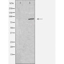 DF3528 staining HepG2 by IF/ICC. The sample were fixed with PFA and permeabilized in 0.1% Triton X-100,then blocked in 10% serum for 45 minutes at 25¡ãC. The primary antibody was diluted at 1/200 and incubated with the sample for 1 hour at 37¡ãC. An Alexa Fluor 594 conjugated goat anti-rabbit IgG (H+L) Ab, diluted at 1/600, was used as the secondary antibod