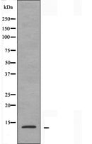 DF3681 staining HuvEc cells by IF/ICC. The sample were fixed with PFA and permeabilized in 0.1% Triton X-100,then blocked in 10% serum for 45 minutes at 25¡ãC. The primary antibody was diluted at 1/200 and incubated with the sample for 1 hour at 37¡ãC. An Alexa Fluor 594 conjugated goat anti-rabbit IgG (H+L) antibody(Cat.