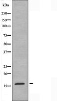 DF3682 staining Hela cells by IF/ICC. The sample were fixed with PFA and permeabilized in 0.1% Triton X-100,then blocked in 10% serum for 45 minutes at 25¡ãC. The primary antibody was diluted at 1/200 and incubated with the sample for 1 hour at 37¡ãC. An Alexa Fluor 594 conjugated goat anti-rabbit IgG (H+L) antibody(Cat.