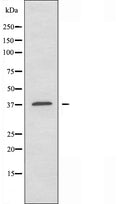 DF3779 staining HeLa by IF/ICC. The sample were fixed with PFA and permeabilized in 0.1% Triton X-100,then blocked in 10% serum for 45 minutes at 25¡ãC. The primary antibody was diluted at 1/200 and incubated with the sample for 1 hour at 37¡ãC. An Alexa Fluor 594 conjugated goat anti-rabbit IgG (H+L) Ab, diluted at 1/600, was used as the secondary antibod