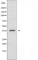 DF3539 staining Hela by IF/ICC. The sample were fixed with PFA and permeabilized in 0.1% Triton X-100,then blocked in 10% serum for 45 minutes at 25¡ãC. The primary antibody was diluted at 1/200 and incubated with the sample for 1 hour at 37¡ãC. An Alexa Fluor 594 conjugated goat anti-rabbit IgG (H+L) Ab, diluted at 1/600, was used as the secondary antibod