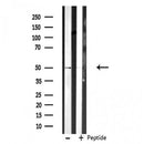 DF3542 staining Hela cells by IF/ICC. The sample were fixed with PFA and permeabilized in 0.1% Triton X-100,then blocked in 10% serum for 45 minutes at 25¡ãC. The primary antibody was diluted at 1/200 and incubated with the sample for 1 hour at 37¡ãC. An Alexa Fluor 594 conjugated goat anti-rabbit IgG (H+L) antibody(Cat.