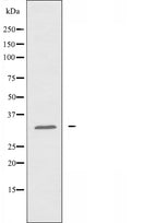 DF3557 staining RAW264.7 by IF/ICC. The sample were fixed with PFA and permeabilized in 0.1% Triton X-100,then blocked in 10% serum for 45 minutes at 25¡ãC. The primary antibody was diluted at 1/200 and incubated with the sample for 1 hour at 37¡ãC. An Alexa Fluor 594 conjugated goat anti-rabbit IgG (H+L) Ab, diluted at 1/600, was used as the secondary antibod