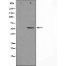 DF3584 staining Hela cells by IF/ICC. The sample were fixed with PFA and permeabilized in 0.1% Triton X-100,then blocked in 10% serum for 45 minutes at 25¡ãC. The primary antibody was diluted at 1/200 and incubated with the sample for 1 hour at 37¡ãC. An Alexa Fluor 594 conjugated goat anti-rabbit IgG (H+L) antibody(Cat.