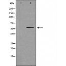 DF3585 staining LOVO cells by IF/ICC. The sample were fixed with PFA and permeabilized in 0.1% Triton X-100,then blocked in 10% serum for 45 minutes at 25¡ãC. The primary antibody was diluted at 1/200 and incubated with the sample for 1 hour at 37¡ãC. An Alexa Fluor 594 conjugated goat anti-rabbit IgG (H+L) antibody(Cat.