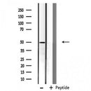 Western blot analysis of extracts from rat heart, using Cytochrome P450 3A4 Antibody. Lane 1 was treated with the blocking peptide.