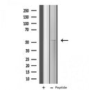 Western blot analysis of extracts from VERO, using Cytochrome P450 4X1 Antibody. The lane on the left was treated with blocking peptide.