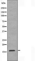 DF3593 at 1/100 staining Human Melanoma tissue by IHC-P. The sample was formaldehyde fixed and a heat mediated antigen retrieval step in citrate buffer was performed. The sample was then blocked and incubated with the antibody for 1.5 hours at 22¡ãC. An HRP conjugated goat anti-rabbit antibody was used as the secondary