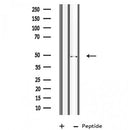 DF3604 staining A549 cells by IF/ICC. The sample were fixed with PFA and permeabilized in 0.1% Triton X-100,then blocked in 10% serum for 45 minutes at 25¡ãC. The primary antibody was diluted at 1/200 and incubated with the sample for 1 hour at 37¡ãC. An Alexa Fluor 594 conjugated goat anti-rabbit IgG (H+L) antibody(Cat.