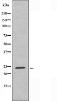 DF3607 staining COLO205 cells by IF/ICC. The sample were fixed with PFA and permeabilized in 0.1% Triton X-100,then blocked in 10% serum for 45 minutes at 25¡ãC. The primary antibody was diluted at 1/200 and incubated with the sample for 1 hour at 37¡ãC. An Alexa Fluor 594 conjugated goat anti-rabbit IgG (H+L) antibody(Cat.