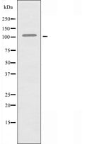 DF3613 staining HepG2? cells by IF/ICC. The sample were fixed with PFA and permeabilized in 0.1% Triton X-100,then blocked in 10% serum for 45 minutes at 25¡ãC. The primary antibody was diluted at 1/200 and incubated with the sample for 1 hour at 37¡ãC. An Alexa Fluor 594 conjugated goat anti-rabbit IgG (H+L) antibody(Cat.