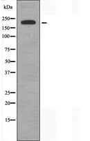 DF3617 at 1/100 staining Mouse testis tissue by IHC-P. The sample was formaldehyde fixed and a heat mediated antigen retrieval step in citrate buffer was performed. The sample was then blocked and incubated with the antibody for 1.5 hours at 22¡ãC. An HRP conjugated goat anti-rabbit antibody was used as the secondary