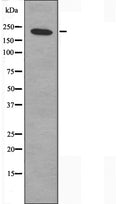DF3618 at 1/100 staining Human uterus tissue by IHC-P. The sample was formaldehyde fixed and a heat mediated antigen retrieval step in citrate buffer was performed. The sample was then blocked and incubated with the antibody for 1.5 hours at 22¡ãC. An HRP conjugated goat anti-rabbit antibody was used as the secondary