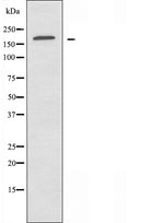 DF3619 staining HuvEc cells by IF/ICC. The sample were fixed with PFA and permeabilized in 0.1% Triton X-100,then blocked in 10% serum for 45 minutes at 25¡ãC. The primary antibody was diluted at 1/200 and incubated with the sample for 1 hour at 37¡ãC. An Alexa Fluor 594 conjugated goat anti-rabbit IgG (H+L) antibody(Cat.