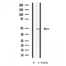 DF3628 staining COLO205 cells by IF/ICC. The sample were fixed with PFA and permeabilized in 0.1% Triton X-100,then blocked in 10% serum for 45 minutes at 25¡ãC. The primary antibody was diluted at 1/200 and incubated with the sample for 1 hour at 37¡ãC. An Alexa Fluor 594 conjugated goat anti-rabbit IgG (H+L) antibody(Cat.