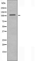 DF3637 staining HepG2 cells by IF/ICC. The sample were fixed with PFA and permeabilized in 0.1% Triton X-100,then blocked in 10% serum for 45 minutes at 25¡ãC. The primary antibody was diluted at 1/200 and incubated with the sample for 1 hour at 37¡ãC. An Alexa Fluor 594 conjugated goat anti-rabbit IgG (H+L) antibody(Cat.