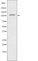 DF3639 at 1/100 staining Human breast cancer tissue by IHC-P. The sample was formaldehyde fixed and a heat mediated antigen retrieval step in citrate buffer was performed. The sample was then blocked and incubated with the antibody for 1.5 hours at 22¡ãC. An HRP conjugated goat anti-rabbit antibody was used as the secondary