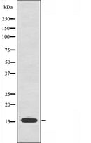 DF3647 at 1/100 staining Mouse muscle tissue by IHC-P. The sample was formaldehyde fixed and a heat mediated antigen retrieval step in citrate buffer was performed. The sample was then blocked and incubated with the antibody for 1.5 hours at 22¡ãC. An HRP conjugated goat anti-rabbit antibody was used as the secondary
