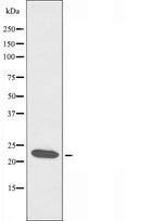 DF3651 at 1/100 staining Mouse muscle tissue by IHC-P. The sample was formaldehyde fixed and a heat mediated antigen retrieval step in citrate buffer was performed. The sample was then blocked and incubated with the antibody for 1.5 hours at 22¡ãC. An HRP conjugated goat anti-rabbit antibody was used as the secondary