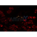 Western blot analysis of extracts from HepG2, using MRPL32 Antibody. Lane 1 was treated with the antigen-specific peptide.