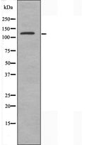DF3692 at 1/100 staining Human cervical cancer tissue by IHC-P. The sample was formaldehyde fixed and a heat mediated antigen retrieval step in citrate buffer was performed. The sample was then blocked and incubated with the antibody for 1.5 hours at 22¡ãC. An HRP conjugated goat anti-rabbit antibody was used as the secondary