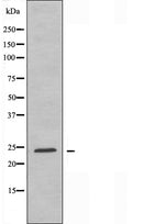 DF3694 staining HeLa cells by IF/ICC. The sample were fixed with PFA and permeabilized in 0.1% Triton X-100,then blocked in 10% serum for 45 minutes at 25¡ãC. The primary antibody was diluted at 1/200 and incubated with the sample for 1 hour at 37¡ãC. An Alexa Fluor 594 conjugated goat anti-rabbit IgG (H+L) antibody(Cat.