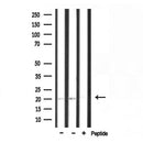 DF3698 staining LOVO cells by IF/ICC. The sample were fixed with PFA and permeabilized in 0.1% Triton X-100,then blocked in 10% serum for 45 minutes at 25¡ãC. The primary antibody was diluted at 1/200 and incubated with the sample for 1 hour at 37¡ãC. An Alexa Fluor 594 conjugated goat anti-rabbit IgG (H+L) antibody(Cat.
