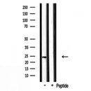 DF3699 at 1/100 staining Rat kidney tissue by IHC-P. The sample was formaldehyde fixed and a heat mediated antigen retrieval step in citrate buffer was performed. The sample was then blocked and incubated with the antibody for 1.5 hours at 22¡ãC. An HRP conjugated goat anti-rabbit antibody was used as the secondary