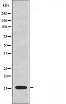 DF3702 at 1/100 staining Rat spleen tissue by IHC-P. The sample was formaldehyde fixed and a heat mediated antigen retrieval step in citrate buffer was performed. The sample was then blocked and incubated with the antibody for 1.5 hours at 22¡ãC. An HRP conjugated goat anti-rabbit antibody was used as the secondary