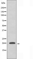DF3703 staining HuvEc cells by IF/ICC. The sample were fixed with PFA and permeabilized in 0.1% Triton X-100,then blocked in 10% serum for 45 minutes at 25¡ãC. The primary antibody was diluted at 1/200 and incubated with the sample for 1 hour at 37¡ãC. An Alexa Fluor 594 conjugated goat anti-rabbit IgG (H+L) antibody(Cat.