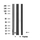 DF3708 staining HepG2 cells by IF/ICC. The sample were fixed with PFA and permeabilized in 0.1% Triton X-100,then blocked in 10% serum for 45 minutes at 25¡ãC. The primary antibody was diluted at 1/200 and incubated with the sample for 1 hour at 37¡ãC. An Alexa Fluor 594 conjugated goat anti-rabbit IgG (H+L) antibody(Cat.
