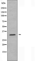 DF3715 at 1/100 staining Human prostate tissue by IHC-P. The sample was formaldehyde fixed and a heat mediated antigen retrieval step in citrate buffer was performed. The sample was then blocked and incubated with the antibody for 1.5 hours at 22¡ãC. An HRP conjugated goat anti-rabbit antibody was used as the secondary