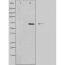 DF3725 staining HepG2 by IF/ICC. The sample were fixed with PFA and permeabilized in 0.1% Triton X-100,then blocked in 10% serum for 45 minutes at 25¡ãC. The primary antibody was diluted at 1/200 and incubated with the sample for 1 hour at 37¡ãC. An Alexa Fluor 594 conjugated goat anti-rabbit IgG (H+L) Ab, diluted at 1/600, was used as the secondary antibod