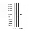 DF3726 staining HepG2 by IF/ICC. The sample were fixed with PFA and permeabilized in 0.1% Triton X-100,then blocked in 10% serum for 45 minutes at 25¡ãC. The primary antibody was diluted at 1/200 and incubated with the sample for 1 hour at 37¡ãC. An Alexa Fluor 594 conjugated goat anti-rabbit IgG (H+L) Ab, diluted at 1/600, was used as the secondary antibod
