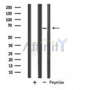 Western blot analysis of SLC33A1 expression in Human Placenta lysate