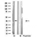 DF3752 staining COLO205 cells by IF/ICC. The sample were fixed with PFA and permeabilized in 0.1% Triton X-100,then blocked in 10% serum for 45 minutes at 25¡ãC. The primary antibody was diluted at 1/200 and incubated with the sample for 1 hour at 37¡ãC. An Alexa Fluor 594 conjugated goat anti-rabbit IgG (H+L) antibody(Cat.