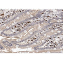 AF0203 at 1/100 staining human colon carcinoma tissue sections by IHC-P. The tissue was formaldehyde fixed and a heat mediated antigen retrieval step in citrate buffer was performed. The tissue was then blocked and incubated with the antibody for 1.5 hours at 22¡ãC. An HRP conjugated goat anti-rabbit antibody was used as the secondary