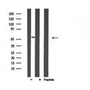 DF3793 staining HeLa cells by IF/ICC. The sample were fixed with PFA and permeabilized in 0.1% Triton X-100,then blocked in 10% serum for 45 minutes at 25¡ãC. The primary antibody was diluted at 1/200 and incubated with the sample for 1 hour at 37¡ãC. An Alexa Fluor 594 conjugated goat anti-rabbit IgG (H+L) antibody(Cat.
