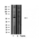 DF3794 at 1/100 staining Mouse liver tissue by IHC-P. The sample was formaldehyde fixed and a heat mediated antigen retrieval step in citrate buffer was performed. The sample was then blocked and incubated with the antibody for 1.5 hours at 22¡ãC. An HRP conjugated goat anti-rabbit antibody was used as the secondary