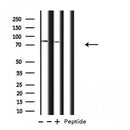 Western blot analysis of ATXN7L2 expression in various lysates