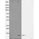 DF3803 staining COLO205 by IF/ICC. The sample were fixed with PFA and permeabilized in 0.1% Triton X-100,then blocked in 10% serum for 45 minutes at 25¡ãC. The primary antibody was diluted at 1/200 and incubated with the sample for 1 hour at 37¡ãC. An Alexa Fluor 594 conjugated goat anti-rabbit IgG (H+L) Ab, diluted at 1/600, was used as the secondary antibod