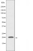 DF3807 staining A549 by IF/ICC. The sample were fixed with PFA and permeabilized in 0.1% Triton X-100,then blocked in 10% serum for 45 minutes at 25¡ãC. The primary antibody was diluted at 1/200 and incubated with the sample for 1 hour at 37¡ãC. An Alexa Fluor 594 conjugated goat anti-rabbit IgG (H+L) Ab, diluted at 1/600, was used as the secondary antibod