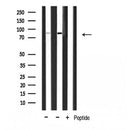DF3815 staining HeLa cells by IF/ICC. The sample were fixed with PFA and permeabilized in 0.1% Triton X-100,then blocked in 10% serum for 45 minutes at 25¡ãC. The primary antibody was diluted at 1/200 and incubated with the sample for 1 hour at 37¡ãC. An Alexa Fluor 594 conjugated goat anti-rabbit IgG (H+L) antibody(Cat.