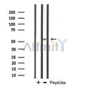 Western blot analysis of extracts from various samples, using DDX19B Antibody. Lane 1: Hela treated with the antigen-specific peptide. Lane 2: Hela; Lane 3: 293;