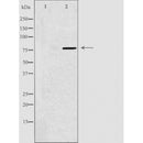 DF3823 staining HepG2 by IF/ICC. The sample were fixed with PFA and permeabilized in 0.1% Triton X-100,then blocked in 10% serum for 45 minutes at 25¡ãC. The primary antibody was diluted at 1/200 and incubated with the sample for 1 hour at 37¡ãC. An Alexa Fluor 594 conjugated goat anti-rabbit IgG (H+L) Ab, diluted at 1/600, was used as the secondary antibod