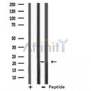 DF3864 staining HeLa by IF/ICC. The sample were fixed with PFA and permeabilized in 0.1% Triton X-100,then blocked in 10% serum for 45 minutes at 25¡ãC. The primary antibody was diluted at 1/200 and incubated with the sample for 1 hour at 37¡ãC. An Alexa Fluor 594 conjugated goat anti-rabbit IgG (H+L) Ab, diluted at 1/600, was used as the secondary antibod
