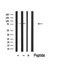 DF3879 staining HepG2 by IF/ICC. The sample were fixed with PFA and permeabilized in 0.1% Triton X-100,then blocked in 10% serum for 45 minutes at 25¡ãC. The primary antibody was diluted at 1/200 and incubated with the sample for 1 hour at 37¡ãC. An Alexa Fluor 594 conjugated goat anti-rabbit IgG (H+L) Ab, diluted at 1/600, was used as the secondary antibod