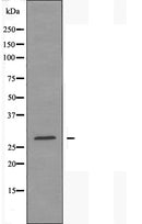 DF3885 at 1/100 staining Human prostate tissue by IHC-P. The sample was formaldehyde fixed and a heat mediated antigen retrieval step in citrate buffer was performed. The sample was then blocked and incubated with the antibody for 1.5 hours at 22¡ãC. An HRP conjugated goat anti-rabbit antibody was used as the secondary